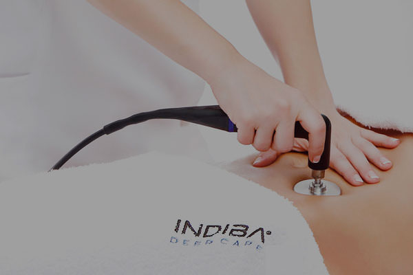 Indiba Barcelona: por qué elegir nuestra clínica para la mejor diatermia del mercado