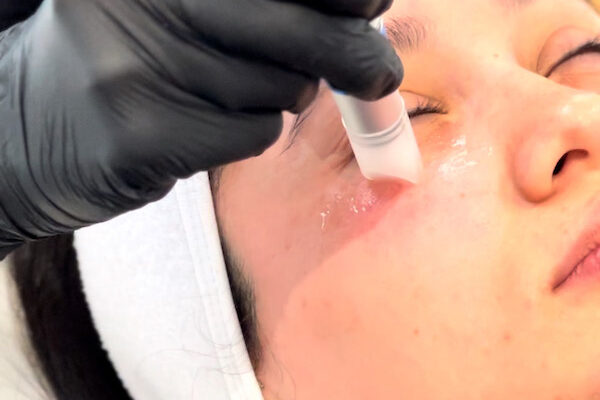 Exosomas-tratamiento-facial-Barcelona Exosomas-tratamiento-facial-Barcelona
