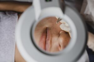 Tratamiento con exosomas: 5 claves para elegirlo