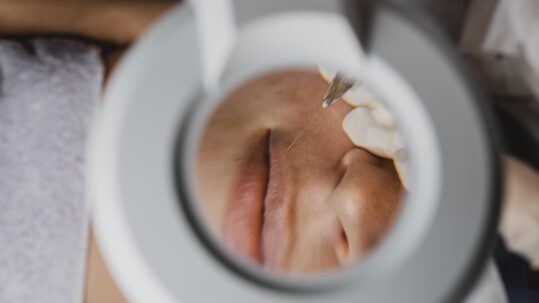 Tratamiento con exosomas: 5 claves para elegirlo